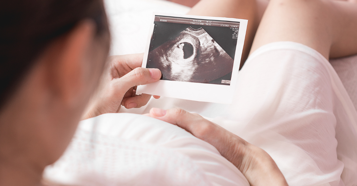 badania prenatalne na nfz - kobieta w ciąży patrzy na zdjęcie usg