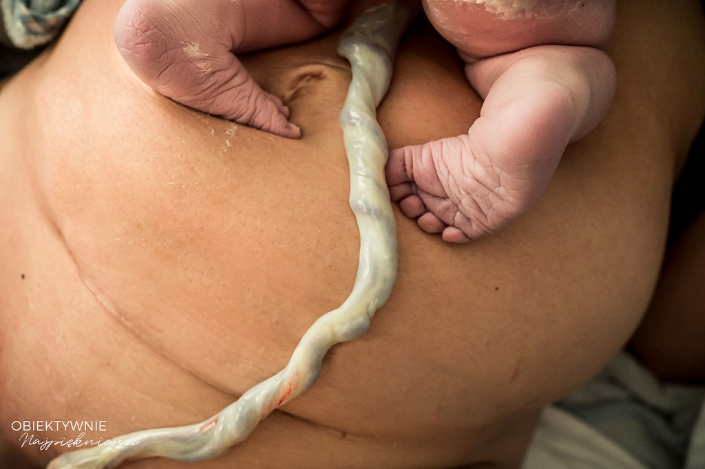 10 lat VBAC na Żelaznej – kiedy marzenie o naturalnym porodzie staje się rzeczywistością